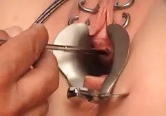 Hahal đã phim se x nhật ban có một tay, cũng như trên khuôn mặt của mình